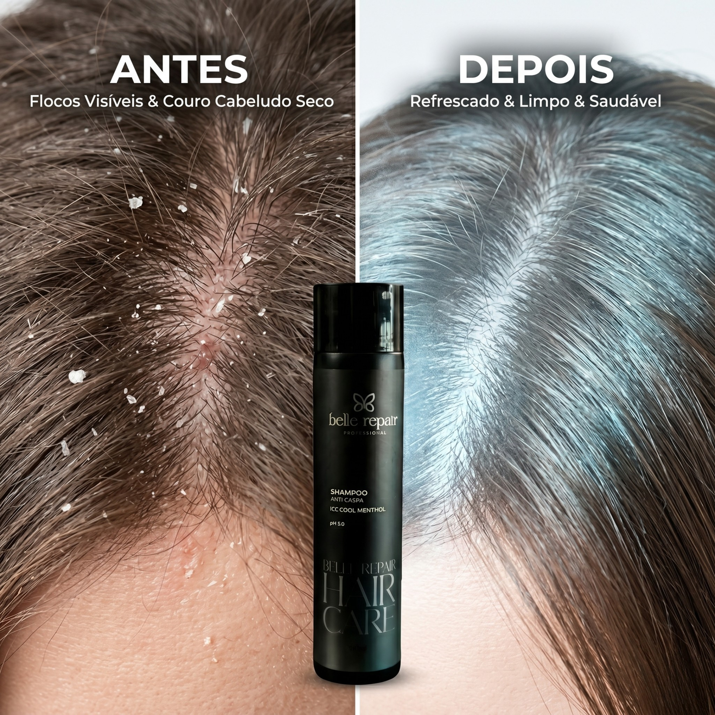 Shampoo Anti caspa