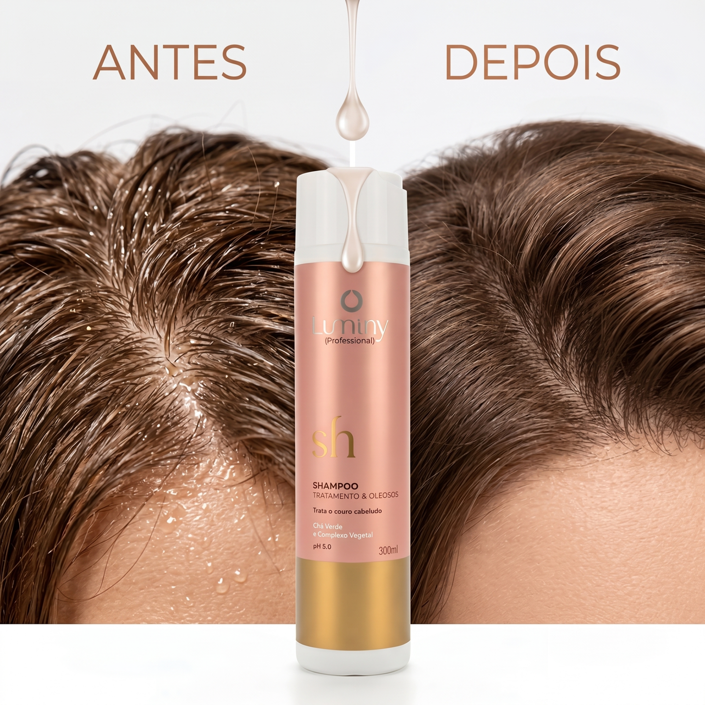 Shampoo Tratamento &amp; Oleosos